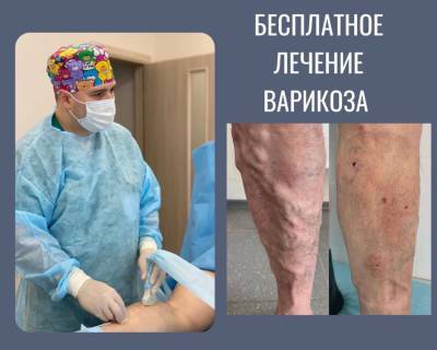 Бесплатное лечение варикоза жителям Республики Удмуртия! - gorodglazov.com - респ. Удмуртия