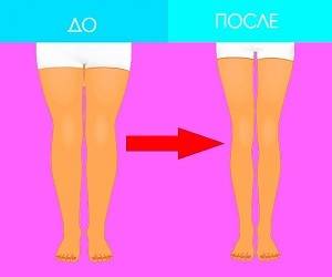 Как похудеть в ногах: 12 упражнений, которые попадают точно в цель - goodnews.ua