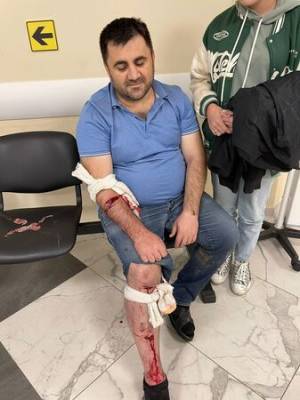 На известного стоматолога Вартана Саркисяна напали в Москве - vkurse.net - Москва - Московская обл. - район Одинцовский