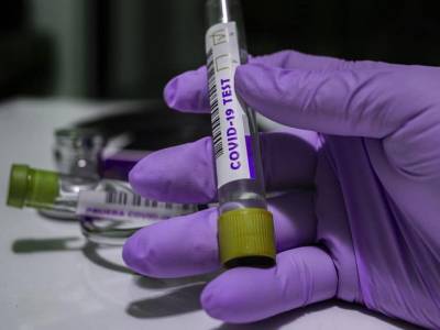 Игорь Кузин - Показатели COVID-19 в Украине достигли нового четырехмесячного максимума - gordonua.com - Китай - Украина