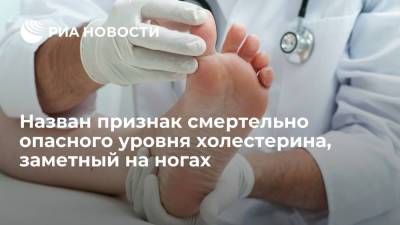 Daily Express: избыток холестерина в организме замедляет рост ногтей на ногах - ria.ru - Москва - Англия - Великобритания