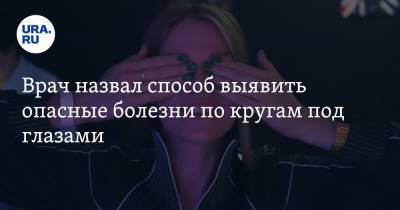 Врач назвал способ выявить опасные болезни по кругам под глазами - ura.news