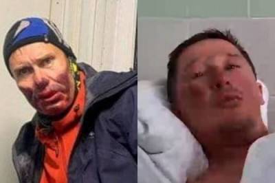 "Гидов мы не обвиняем": выжившие после восхождения на Эльбрус рассказали о походе - skuke.net - Интересно