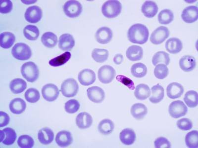 Возбудитель малярии научился скрываться от диагностических тестов - polit.ru - шт.Северная Каролина - Эфиопия