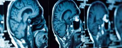 Neuron: американские ученые рассказали, чем мозг человека отличается от мозга других млекопитающих - runews24.ru