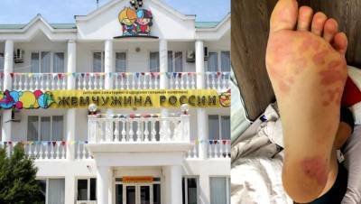 Вирус Коксаки, тучи комаров, отвратная еда: как отдыхают дети в "Жемчужине России" - newsland.com - Москва - Россия - Анапа - Краснодарский край