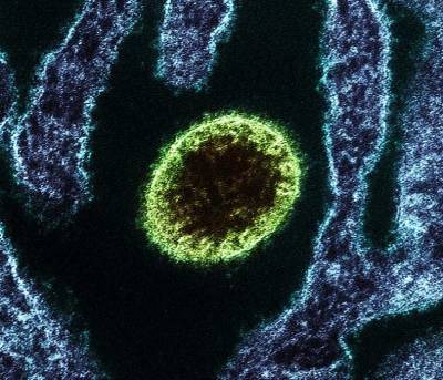 В Индии от вируса Nipah умер 12-летний мальчик - actualnews.org - Индия - Малайзия - штат Керала