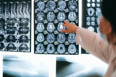 Ученые рассказали, как обнаружить первый признак болезни Альцгеймера - abnews.ru - Каунас