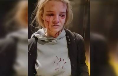 Жительница Подмосковья пострадала из-за неисправного пассажирского лифта - govoritmoskva.ru - Москва - Московская обл. - Красногорск