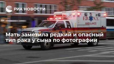 Мать заметила редкий и опасный тип рака у сына по фотографии - ria.ru - Москва - США