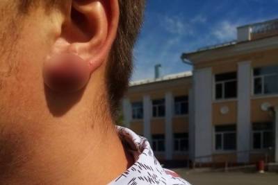 В Курской области директор школы порвал ухо подростку за отказ снять серьгу - mk.ru - Курская обл.