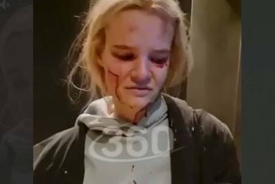 Жительница Подмосковья оказалась в крови после поездки на лифте - lenta.ru - Московская обл. - Красногорск