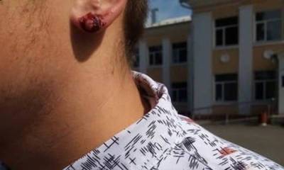 Директор школы порвал ученику ухо за отказ снять серьгу - gubdaily.ru - Курская обл. - Курск
