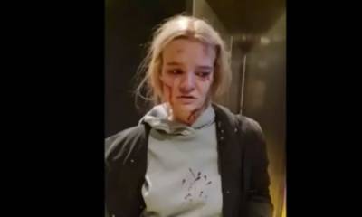 «Очнулась на полу в крови». Девушка чудом выжила в сорвавшемся вниз лифте - gubdaily.ru - Красногорск