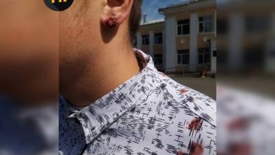 Директор курской школы вырвал у ученика серьгу вместе с ухом - newsland.com - Курская обл.