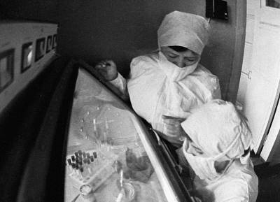 Загадочная эпидемия в Черновцах в 1988 году: почему у детей выпали волосы - russian7.ru - Украина - Черновцы
