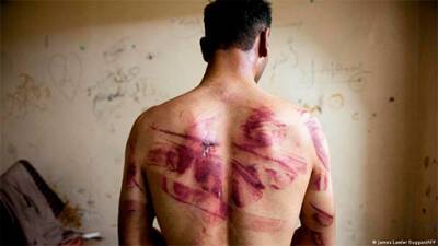 Башар Асад - Приговор пыточной системе Башара Асада вынесут в Кобленце - bin.ua - Сирия - Дамаск - Украина - Германия - земля Рейнланд-Пфальц
