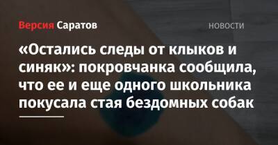 «Остались следы от клыков и синяк»: покровчанка сообщила, что ее и еще одного школьника покусала стая бездомных собак - nversia.ru - Саратовская обл. - Солнечный - район Октябрьский