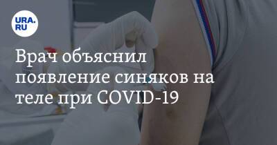 Андрей Кондрахин - Врач объяснил появление синяков на теле при COVID-19 - ura.news
