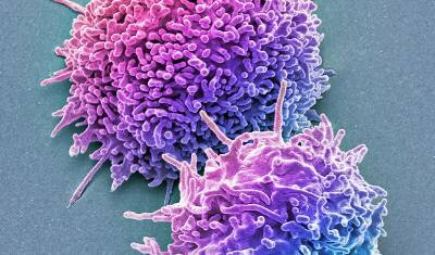 Nature: Не антитела, а иммунные клетки-убийцы способны противостоять "Омикрону" - newizv.ru - Бостон - Юар - шт. Массачусетс - Кейптаун