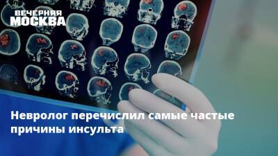 Невролог перечислил самые частые причины инсульта - vm.ru