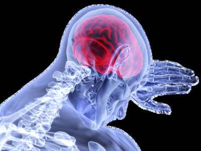Н.Н.Блохин - Россиянам подсказали, какие симптомы могут указывать на опухоль мозга - rosbalt.ru
