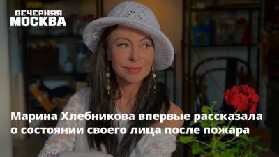 Марина Хлебникова - Марина Хлебникова впервые рассказала о состоянии своего лица после пожара - vm.ru - Москва - Россия
