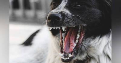 Бродячая собака изгрызла лицо маленькой девочке на Сахалине - ren.tv - Забайкальский край - Сахалин