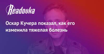 Оскар Кучер - Оскар Кучера показал, как его изменила тяжелая болезнь - readovka.ru