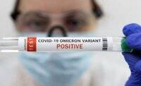 Cколько “Омикрон” может жить на разных поверхностях – исследование - vlasti.net - Колумбия - Reuters