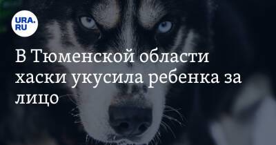 В Тюменской области хаски укусила ребенка за лицо. Владелец пса заплатит 50 тысяч рублей - ura.news - Тюменская обл. - Югра