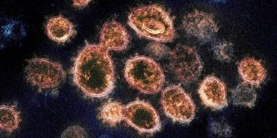 Новый потенциально опасный для человека коронавирус обнаружили в ЮАР - trend.az - Юар