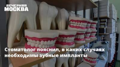 Стоматолог пояснил, в каких случаях необходимы зубные импланты - vm.ru