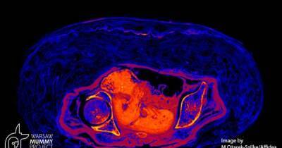 Беременная египетская мумия: ученые выяснили, как сохранился плод возрастом 2 тыс. лет - focus.ua - Украина - Египет - Варшава