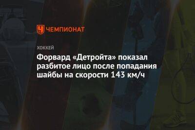 Форвард «Детройта» показал разбитое лицо после попадания шайбы на скорости 143 км/ч - championat.com - Лос-Анджелес