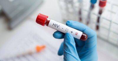 В Латвии появились экспресс-тесты для самодиагностики ВИЧ - koronavirus.center - Латвия