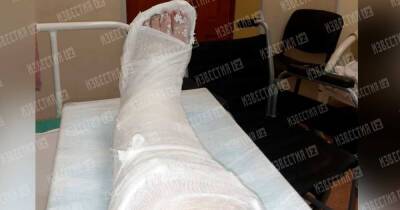 Избитая подростками в Екатеринбурге о нападении: Они сломали мне ногу - ren.tv - Екатеринбург