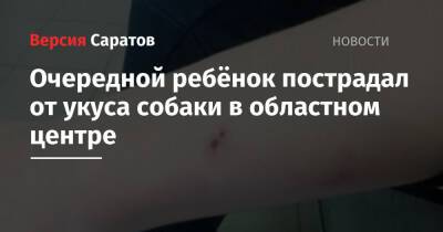 Очередной ребёнок пострадал от укуса собаки в областном центре - nversia.ru - Саратовская обл. - Саратов - район Ленинский, Саратов