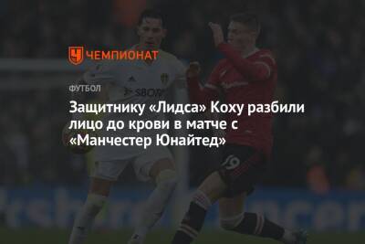 Защитнику «Лидса» Коху разбили лицо до крови в матче с «Манчестер Юнайтед» - championat.com - Италия