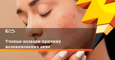 Ученые назвали причину возникновения акне - ridus.ru - Англия