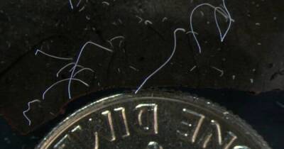 Размером с муху. Ученые нашли самую большую бактерию (фото) - focus.ua - Украина