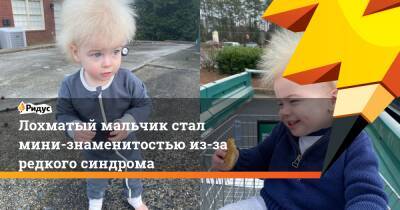 Лохматый мальчик стал мини-знаменитостью из-за редкого синдрома - ridus.ru - Россия