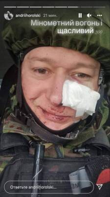 Лидер группы "Бумбокс" получил ранение - vedomosti-ua.com - Украина