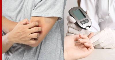 Симптомы диабета: 2 необычных кожных проявления укажут на высокий сахар - profile.ru - США