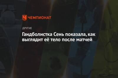 Гандболистка Сень показала, как выглядит её тело после матчей - championat.com - Россия