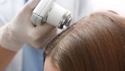 Что делать при выпадении волос, советует врач-трихолог Валентина Приймак - fokus-vnimaniya.com - Новости