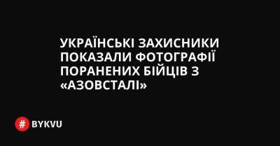 Українські захисники показали фотографії поранених бійців з «Азовсталі» - bykvu.com - Україна - місто Маріуполь