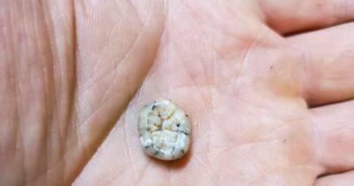 В самом неожиданном месте. В Лаосе впервые нашли зуб денисовца возрастом 130 000 лет - focus.ua - Украина - Лаос