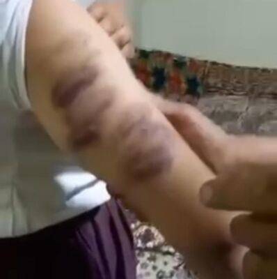 В соцсетях распространилось видео с избитой восьмиклассницей из Бухары. Отец девочки заявил, что это сделал директор школы - podrobno.uz - Узбекистан - Ташкент