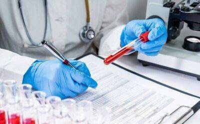 Кипрские ученые обнаружили новый штамм ВИЧ - koronavirus.center - США - Кипр